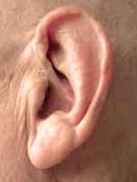 thin tube hearing aid